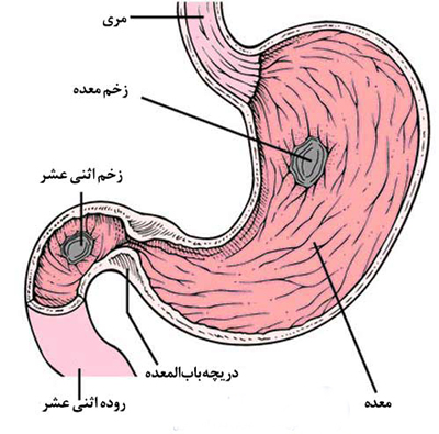 دانلود پاورپوینت کتاب برونر و سودارث گوارش